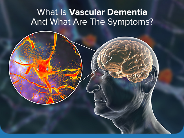 What is Vascular Dementia and What are the Symptoms? |IBS