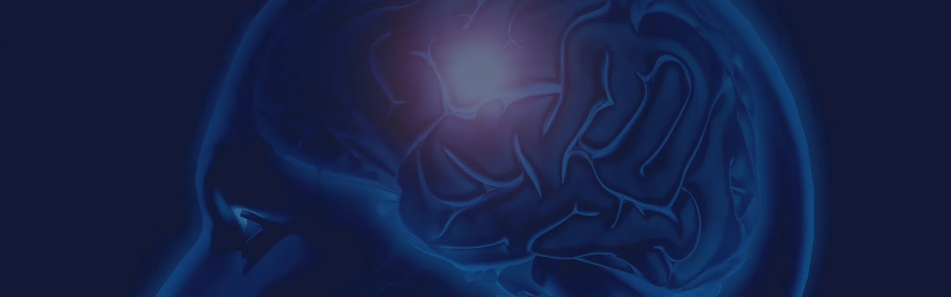 Deep Brain Stimulation (DBS)